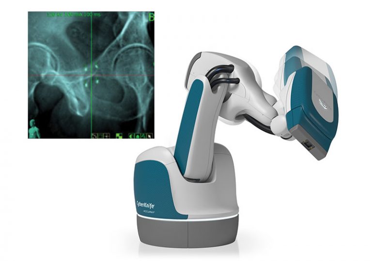 Prostate Srbt Treatment With Cyberknife Accuray 3387